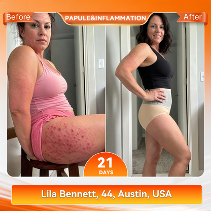 🎁 𝐍𝐞𝐰 𝐘𝐨𝐫𝐤 𝐎𝐧𝐥𝐢𝐧𝐞 𝐒𝐭𝐨𝐫𝐞 🎁 | 🛡️ SEAGRIL® 2026 Moringa & Berberine 4-in-1 Micro-Particle Shaping & Fat Burning Shorts 🎉